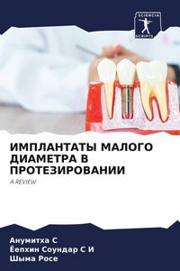 Produktbild: Implantaty Malogo Diametra V Protezirovanii