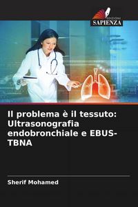 Produktbild: Il problema &egrave; il tessuto: Ultrasonografia endobronchiale e EBUS-TBNA