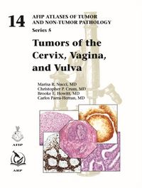 Produktbild: Tumors of the Cervix, Vagina, and Vulva