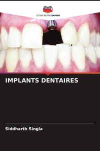 Produktbild: Implants Dentaires