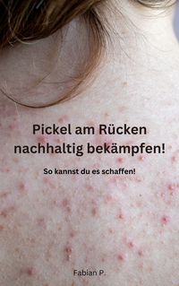 Produktbild: Pickel am R&uuml;cken nachhaltig bek&auml;mpfen!