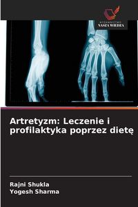 Produktbild: Artretyzm: Leczenie i profilaktyka poprzez diet&iquest;