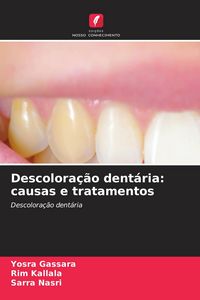Produktbild: Descolora&ccedil;&atilde;o dent&aacute;ria: causas e tratamentos