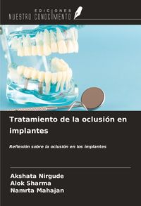 Produktbild: Tratamiento de la oclusi&oacute;n en implantes