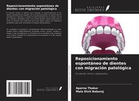 Produktbild: Reposicionamiento espont&aacute;neo de dientes con migraci&oacute;n patol&oacute;gica