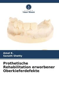 Produktbild: Prothetische Rehabilitation erworbener Oberkieferdefekte