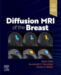 Produktbild: Diffusion MRI of the Breast