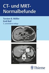 Produktbild: CT und MRT Normalbefunde