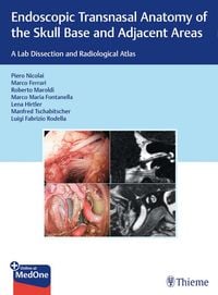 Produktbild: Endoscopic Transnasal Anatomy of the Skull Base and Adjacent Areas
