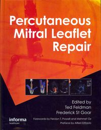 Produktbild: Percutaneous Mitral Leaflet Repair