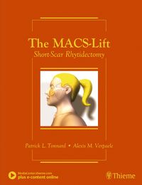 Produktbild: The MACS-Lift