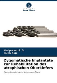 Produktbild: Zygomatische Implantate zur Rehabilitation des atrophischen Oberkiefers