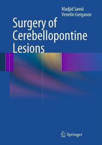 Produktbild: Surgery of Cerebellopontine Lesions