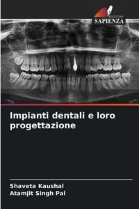 Produktbild: Impianti dentali e loro progettazione