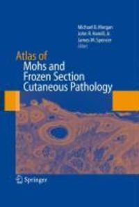 Produktbild: Atlas of Mohs and Frozen Section Cutaneous Pathology