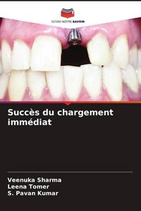 Produktbild: Succ&egrave;s du chargement imm&eacute;diat
