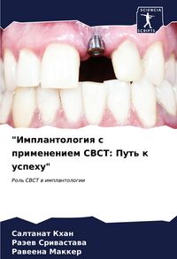 Produktbild: "Implantologiq s primeneniem CBCT: Put' k uspehu"