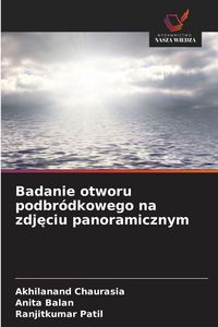 Produktbild: Badanie otworu podbr&oacute;dkowego na zdj&iquest;ciu panoramicznym