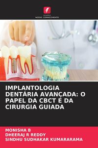 Produktbild: IMPLANTOLOGIA DENT&Aacute;RIA AVAN&Ccedil;ADA: O PAPEL DA CBCT E DA CIRURGIA GUIADA