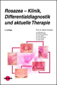 Produktbild: Rosazea &ndash; Klinik, Differentialdiagnostik und aktuelle Therapie