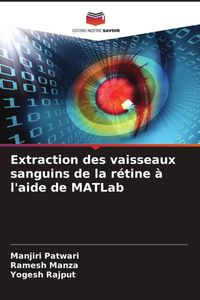 Produktbild: Extraction des vaisseaux sanguins de la r&eacute;tine &agrave; l'aide de MATLab