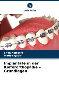 Produktbild: Implantate in der Kieferorthop&auml;die - Grundlagen