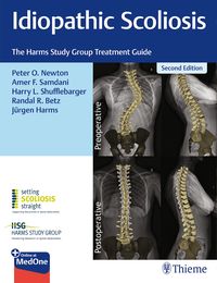 Produktbild: Idiopathic Scoliosis