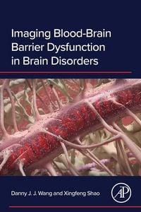 Produktbild: Wang, D: Imaging Blood-Brain Barrier Dysfunction in Brain Di