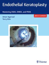 Produktbild: Endothelial Keratoplasty