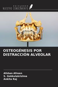 Produktbild: Osteog&eacute;nesis Por Distracci&oacute;n Alveolar