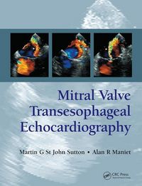 Produktbild: St. John Sutton, M: Mitral Valve Transesophageal Echocardiog