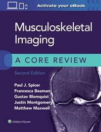 Produktbild: Musculoskeletal Imaging: A Core Review