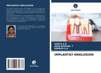 Produktbild: Implantat-Okklusion