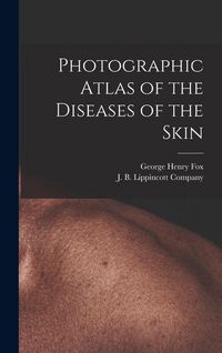 Produktbild: Photographic Atlas of the Diseases of the Skin
