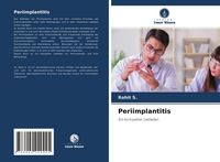 Produktbild: Periimplantitis