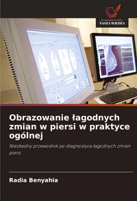 Produktbild: Obrazowanie &iquest;agodnych zmian w piersi w praktyce og&oacute;lnej