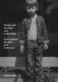 Produktbild: Narben auf der Haut und in der Seele