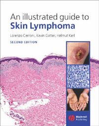 Produktbild: An Illustrated Guide to Skin Lymphoma