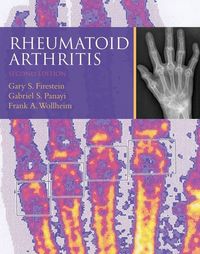Produktbild: Rheumatoid Arthritis Rev/e 2/e