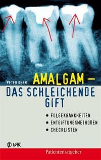 Produktbild: Amalgam - das schleichende Gift
