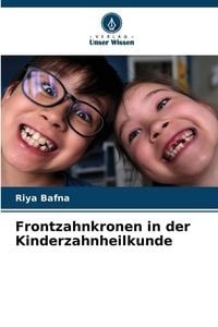 Produktbild: Frontzahnkronen in der Kinderzahnheilkunde