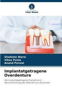 Produktbild: Implantatgetragene Overdenture