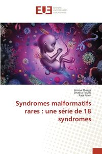 Produktbild: Syndromes malformatifs rares : une s&eacute;rie de 18 syndromes
