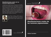 Produktbild: Manifestaciones orales de las lesiones pigmentadas