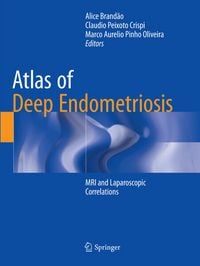 Produktbild: Atlas of Deep Endometriosis