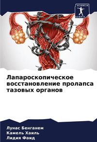 Produktbild: Laparoskopicheskoe wosstanowlenie prolapsa tazowyh organow