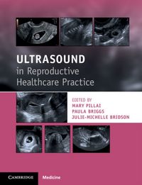Produktbild: Ultrasound in Reproductive Healthcare Practice