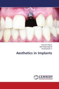Produktbild: Aesthetics in Implants