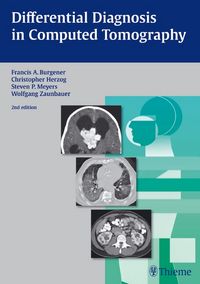 Produktbild: Differential Diagnosis in Computed Tomography