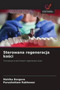 Produktbild: Sterowana regeneracja ko&iquest;ci